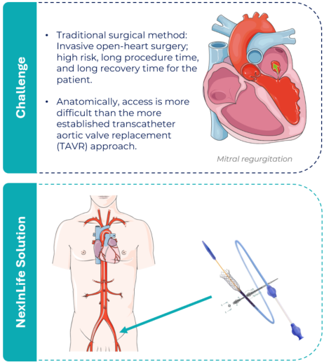 Use case: TMVR delivery system